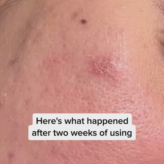 24K Gold Saffron Serum